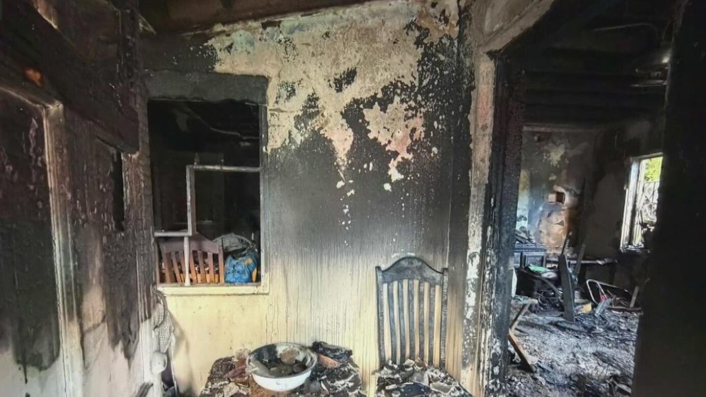 Woman hospitalized after Miami house fire leaves three displaced — CBS Miami, Irving Health news